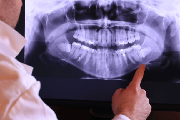 Best Emergency Tooth Extraction in Cheney, KS