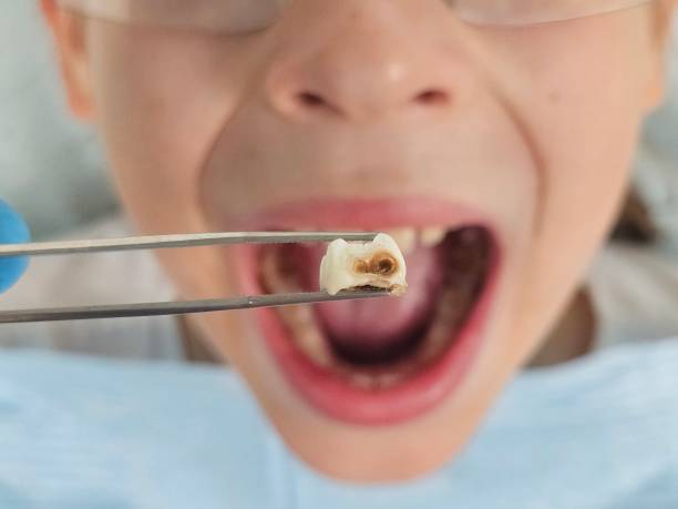 Best Walk-In Emergency Dentist in Cheney, KS