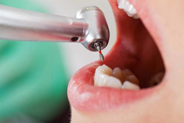 Best Emergency Broken Tooth Repair in Cheney, KS